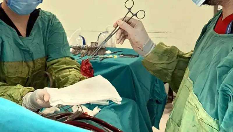 Kalp Kapağı Çürüyen Hastaya Yapılan 7 Saatlik Ameliyat Hayat Kurtardı